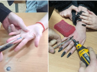 Астраханским девушкам помогли избавиться от тесных колец
