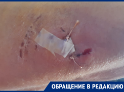 «Швы наложили в трех местах»: в Астраханской области собаки продолжают нападать на людей 