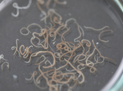 У 6-тилетней астраханки из-за глистов выросла киста размером с куриное яйцо