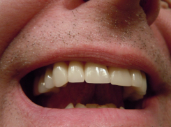 В Астрахани наказали мужчину за длинный язык