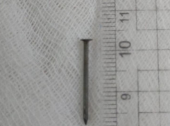 Годовалая астраханка с гвоздем в кишечнике была спасена врачами