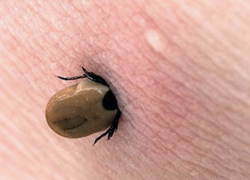 Клещи атакуют астраханцев. Как защититься от укусов и последствий?