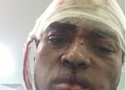 Астраханец избил известного волгоградского диджея 