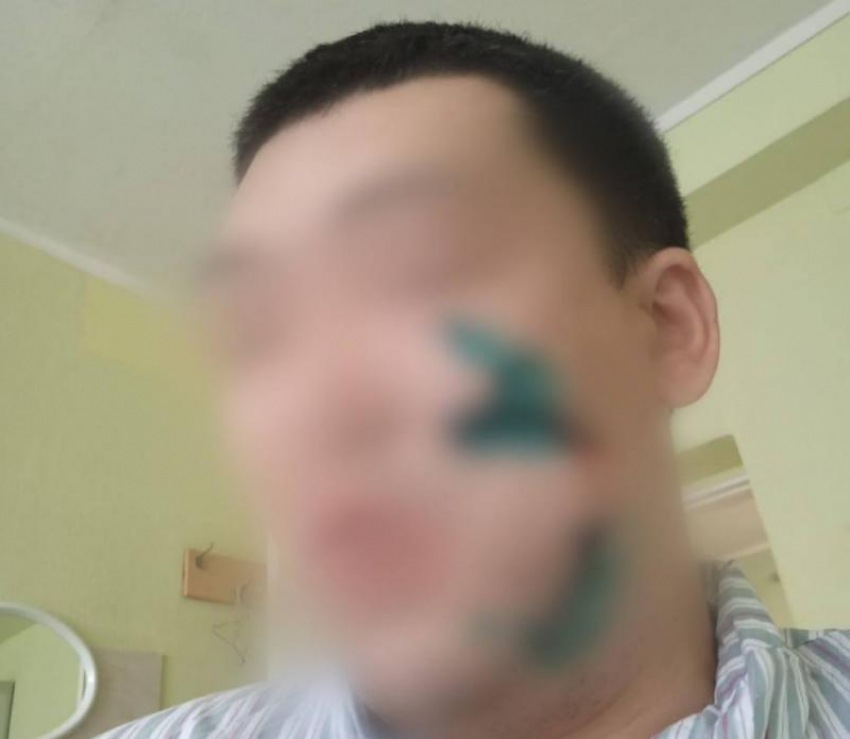 Астраханцу в кафе «Гранат» порезали лицо стаканом за оскорбление посетительницы